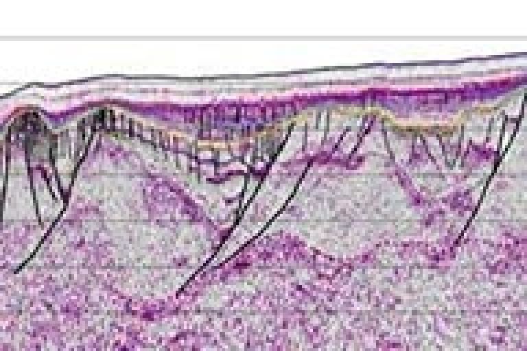 Seismic reflection 